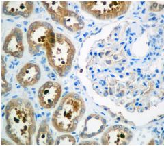 Immunohistochemistry (Formalin/PFA-fixed paraffin-embedded sections) - Anti-UGPase antibody [EPR10627(B)] (AB154817), expandable thumbnail