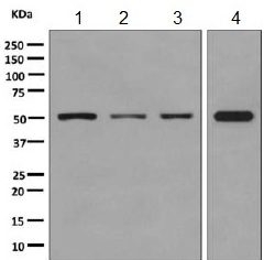 Western blot - Anti-UGPase antibody [EPR10627(B)] (AB154817), expandable thumbnail