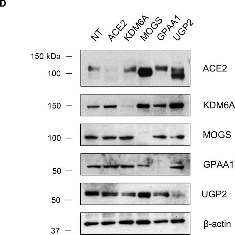 Western blot - Anti-UGPase antibody [EPR10627(B)] (AB154817)