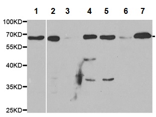 Western blot - Anti-UGT1A1 antibody (AB194697)