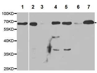 Western blot - Anti-UGT1A1 antibody (AB194697)