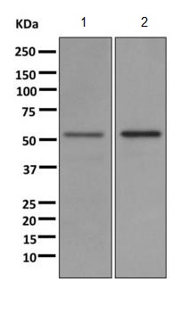 Western blot - Anti-UGT1A1 antibody [EPR9592] (AB170858)