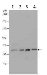 Western blot - Anti-UGT1A6 antibody (AB97646)
