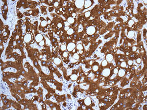 Immunohistochemistry (Formalin/PFA-fixed paraffin-embedded sections) - Anti-UGT1A6 antibody [EPR11068] (AB157476)