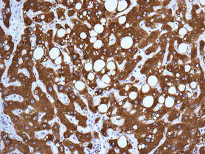 Immunohistochemistry (Formalin/PFA-fixed paraffin-embedded sections) - Anti-UGT1A6 antibody [EPR11068] (AB157476)