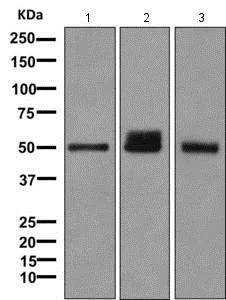 Western blot - Anti-UGT1A6 antibody [EPR11068] (AB157476)