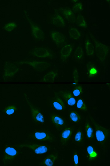 Immunocytochemistry/ Immunofluorescence - Anti-UGT1A9 antibody (AB180707)