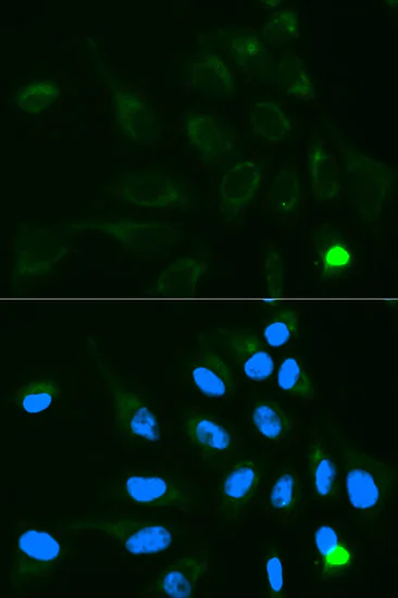 Immunocytochemistry/ Immunofluorescence - Anti-UGT1A9 antibody (AB180707)