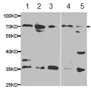 Western blot - Anti-UGT1A9 antibody (AB180707)