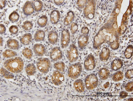 Immunohistochemistry (Formalin/PFA-fixed paraffin-embedded sections) - Anti-UGT1A9 antibody (AB88517), expandable thumbnail