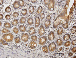 Immunohistochemistry (Formalin/PFA-fixed paraffin-embedded sections) - Anti-UGT1A9 antibody (AB88517)