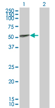 Western blot - Anti-UGT1A9 antibody (AB88517), expandable thumbnail