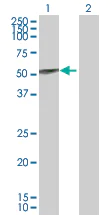 Western blot - Anti-UGT1A9 antibody (AB88517)