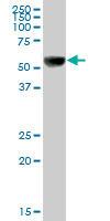Western blot - Anti-UGT1A9 antibody (AB88517), expandable thumbnail