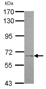 Western blot - Anti-UGT1A9 antibody (AB96214), expandable thumbnail
