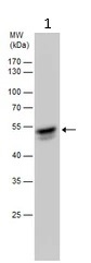 Western blot - Anti-UGT1A9 antibody (AB96214)