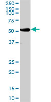 Western blot - Anti-UGT2B15 antibody (AB89274)