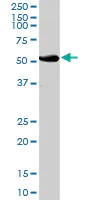 Western blot - Anti-UGT2B15 antibody (AB89274)