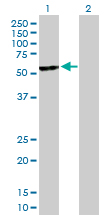 Western blot - Anti-UGT2B15 antibody (AB89274)