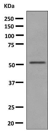 Western blot - Anti-UGT2B15 antibody [EPR10615(B)] (AB154864)