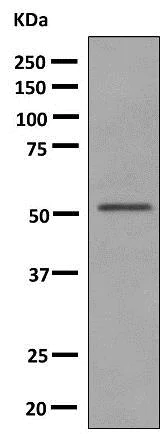 Western blot - Anti-UGT2B15 antibody [EPR10615(B)] (AB154864)