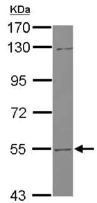 Western blot - Anti-UGT2B7 antibody (AB126269)