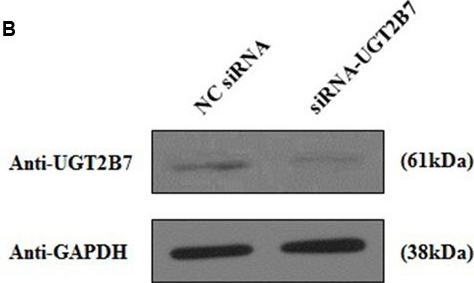 Western blot - Anti-UGT2B7 antibody (AB126269)