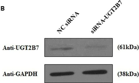 Western blot - Anti-UGT2B7 antibody (AB126269)