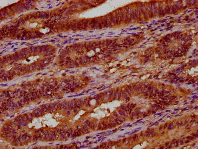 Immunohistochemistry (Formalin/PFA-fixed paraffin-embedded sections) - Anti-UGT2B7 antibody (AB235988)