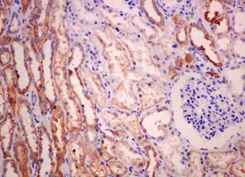 Immunohistochemistry (Formalin/PFA-fixed paraffin-embedded sections) - Anti-UGT3A1 antibody [EPR13723] (AB181245)