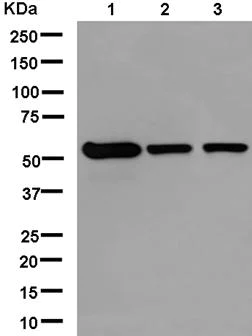 Western blot - Anti-UGT3A1 antibody [EPR13723] (AB181245)