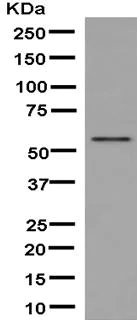 Western blot - Anti-UGT3A1 antibody [EPR13723] (AB181245)