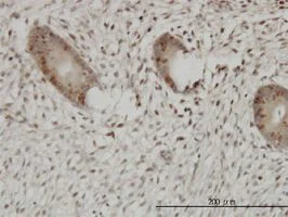 Immunohistochemistry (Formalin/PFA-fixed paraffin-embedded sections) - Anti-UHRF1 antibody [3A11] (AB57083)