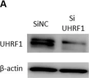 Western blot - Anti-UHRF1 antibody [3A11] (AB57083)