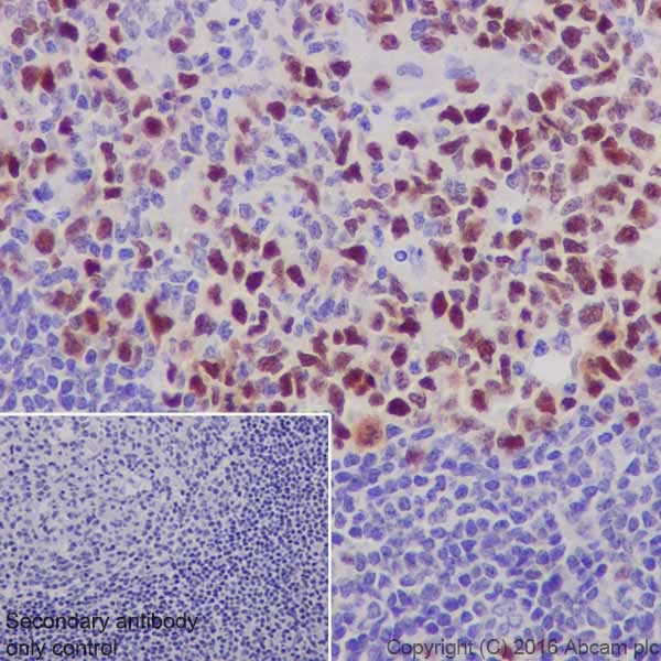 Immunohistochemistry (Formalin/PFA-fixed paraffin-embedded sections) - Anti-UHRF1 antibody [EPR18803-11] - BSA and Azide free (AB240388), expandable thumbnail
