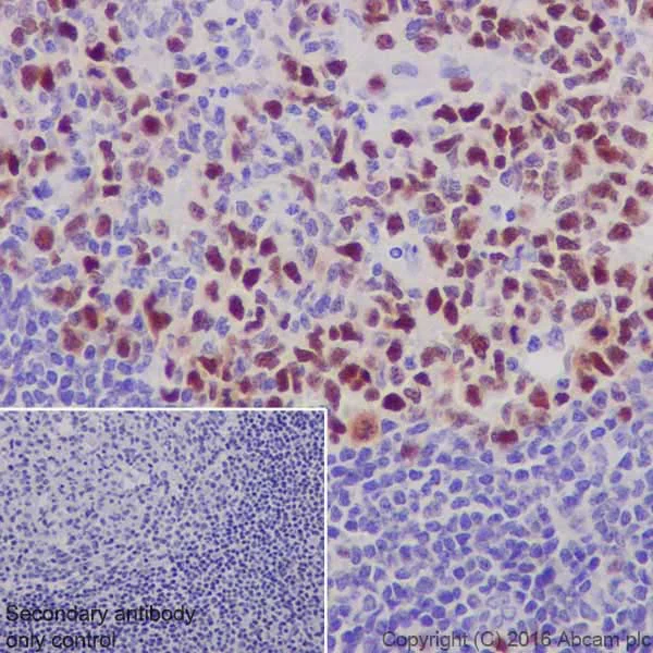 Immunohistochemistry (Formalin/PFA-fixed paraffin-embedded sections) - Anti-UHRF1 antibody [EPR18803-11] - BSA and Azide free (AB240388)