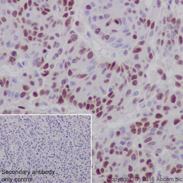 Immunohistochemistry (Formalin/PFA-fixed paraffin-embedded sections) - Anti-UHRF1 antibody [EPR18803-11] - BSA and Azide free (AB240388), expandable thumbnail