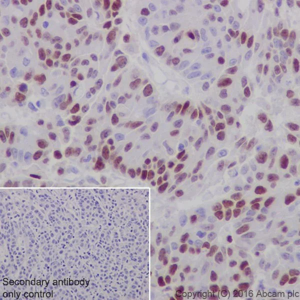 Immunohistochemistry (Formalin/PFA-fixed paraffin-embedded sections) - Anti-UHRF1 antibody [EPR18803-11] - BSA and Azide free (AB240388)