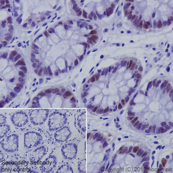 Immunohistochemistry (Formalin/PFA-fixed paraffin-embedded sections) - Anti-UHRF1 antibody [EPR18803] (AB194236)