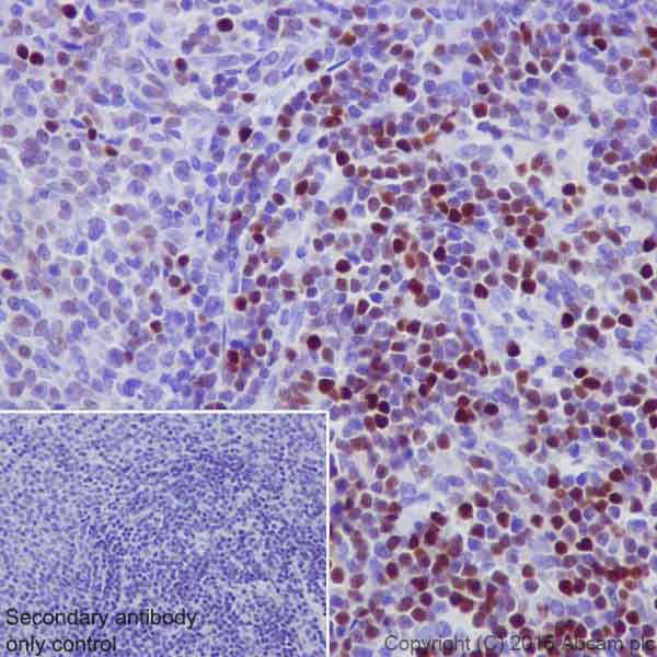 Immunohistochemistry (Formalin/PFA-fixed paraffin-embedded sections) - Anti-UHRF1 antibody [EPR18803] (AB194236)