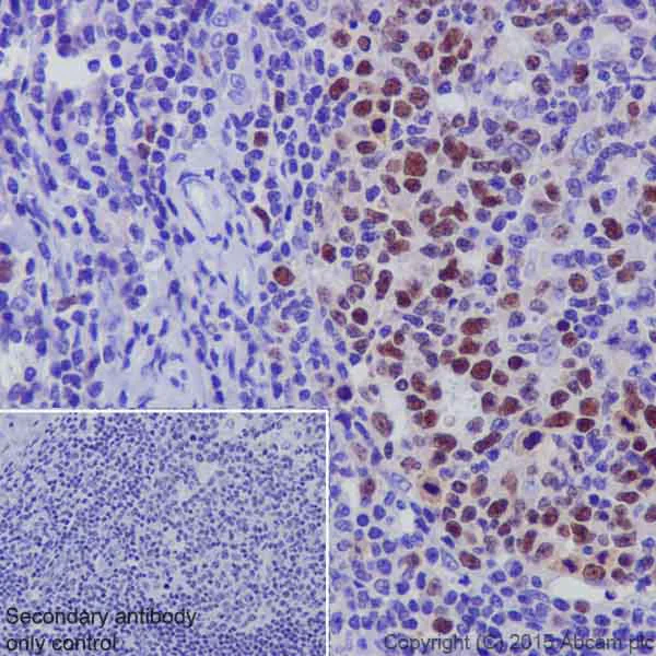 Immunohistochemistry (Formalin/PFA-fixed paraffin-embedded sections) - Anti-UHRF1 antibody [EPR18803] (AB194236)