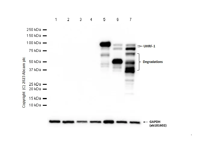 Western blot - Anti-UHRF1 antibody [EPR18803] (AB194236)