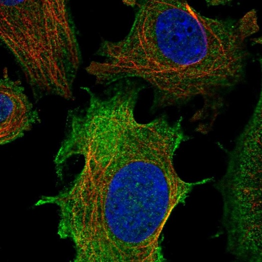 Immunocytochemistry/ Immunofluorescence - Anti-ULBP1 antibody (AB221903), expandable thumbnail
