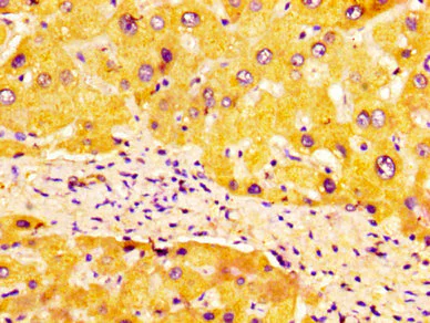 Immunohistochemistry (Formalin/PFA-fixed paraffin-embedded sections) - Anti-ULBP1 antibody (AB238331)