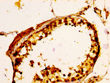 Immunohistochemistry (Formalin/PFA-fixed paraffin-embedded sections) - Anti-ULBP1 antibody (AB238331)