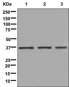 Western blot - Anti-ULBP1 antibody [EPR7532(2)] (AB176566)