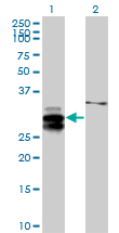 Western blot - Anti-ULBP2 antibody (AB88645), expandable thumbnail