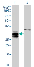 Western blot - Anti-ULBP2 antibody (AB88645)