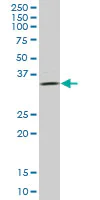 Western blot - Anti-ULBP2 antibody (AB88645)