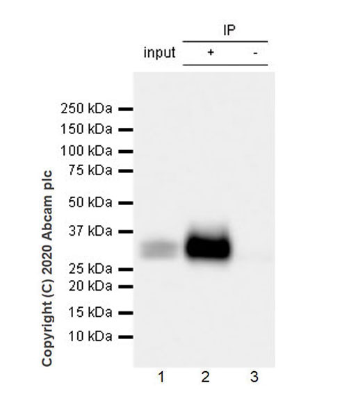 Immunoprecipitation - Anti-ULBP2 antibody [EPR22303-124] (AB275023), expandable thumbnail